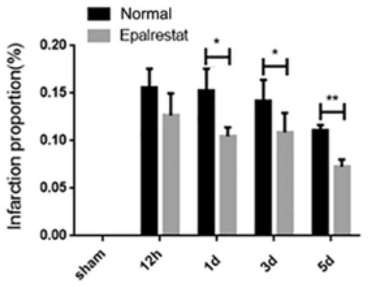 Application of epalrestat in preparation of medicine for preventing and treating cerebral arterial thrombosis