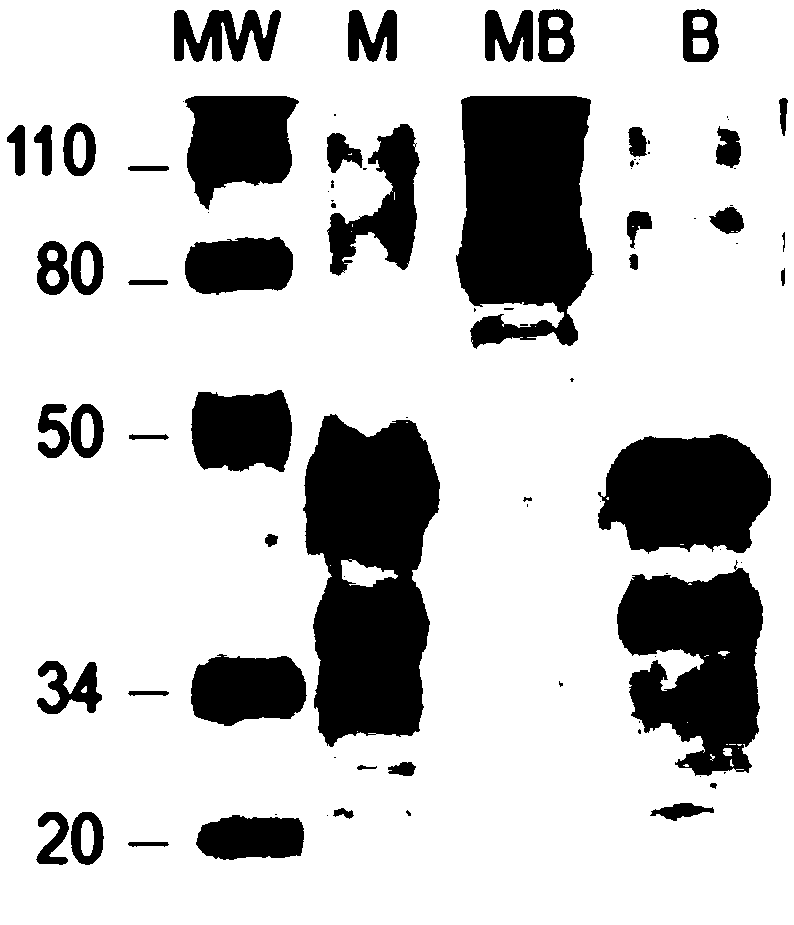 CK-MB type creatine kinase isozyme and preparation method and application thereof