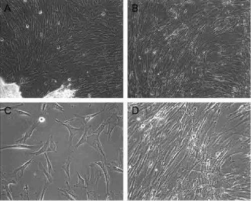 Method for studying action mechanism of Hsa_circ_0111659 in repairing of ESC by WJ-MSCs