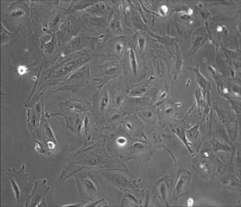 Method for studying action mechanism of Hsa_circ_0111659 in repairing of ESC by WJ-MSCs