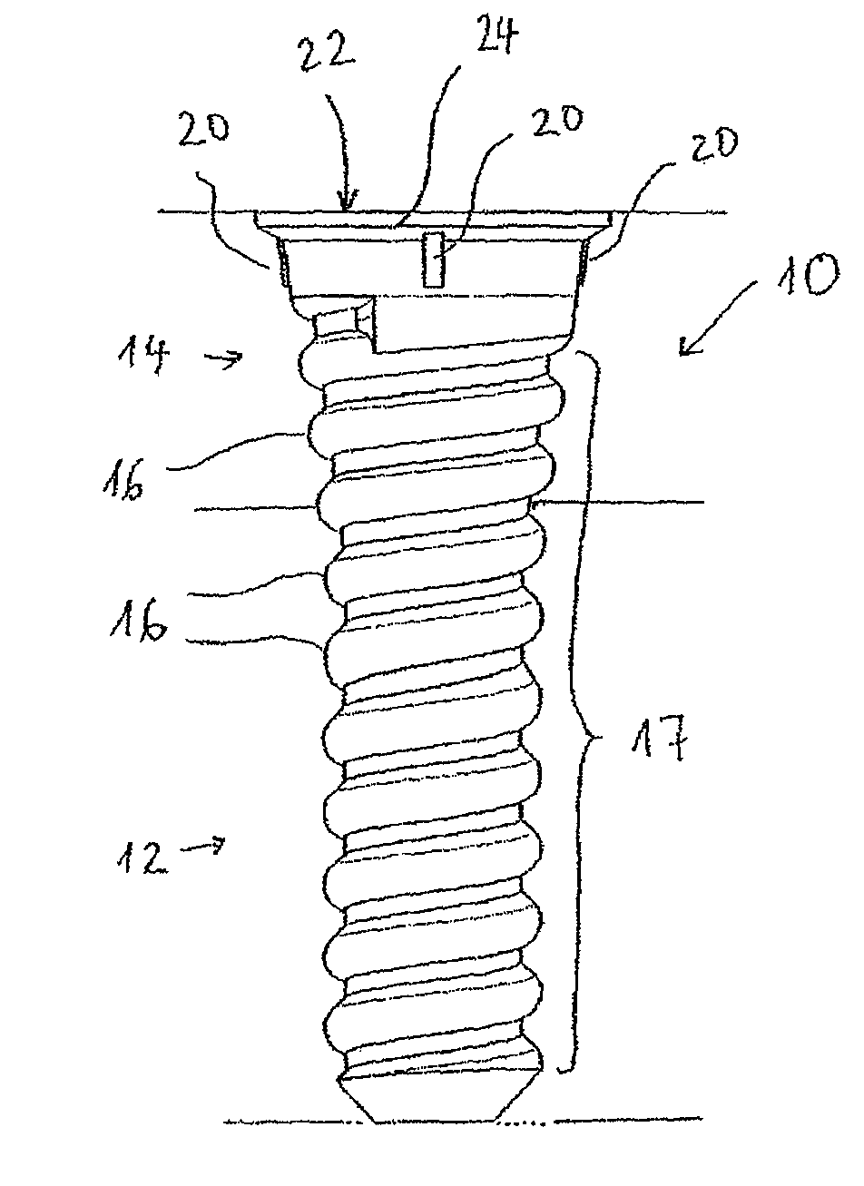 Screw anchor with conical head for rail attachment