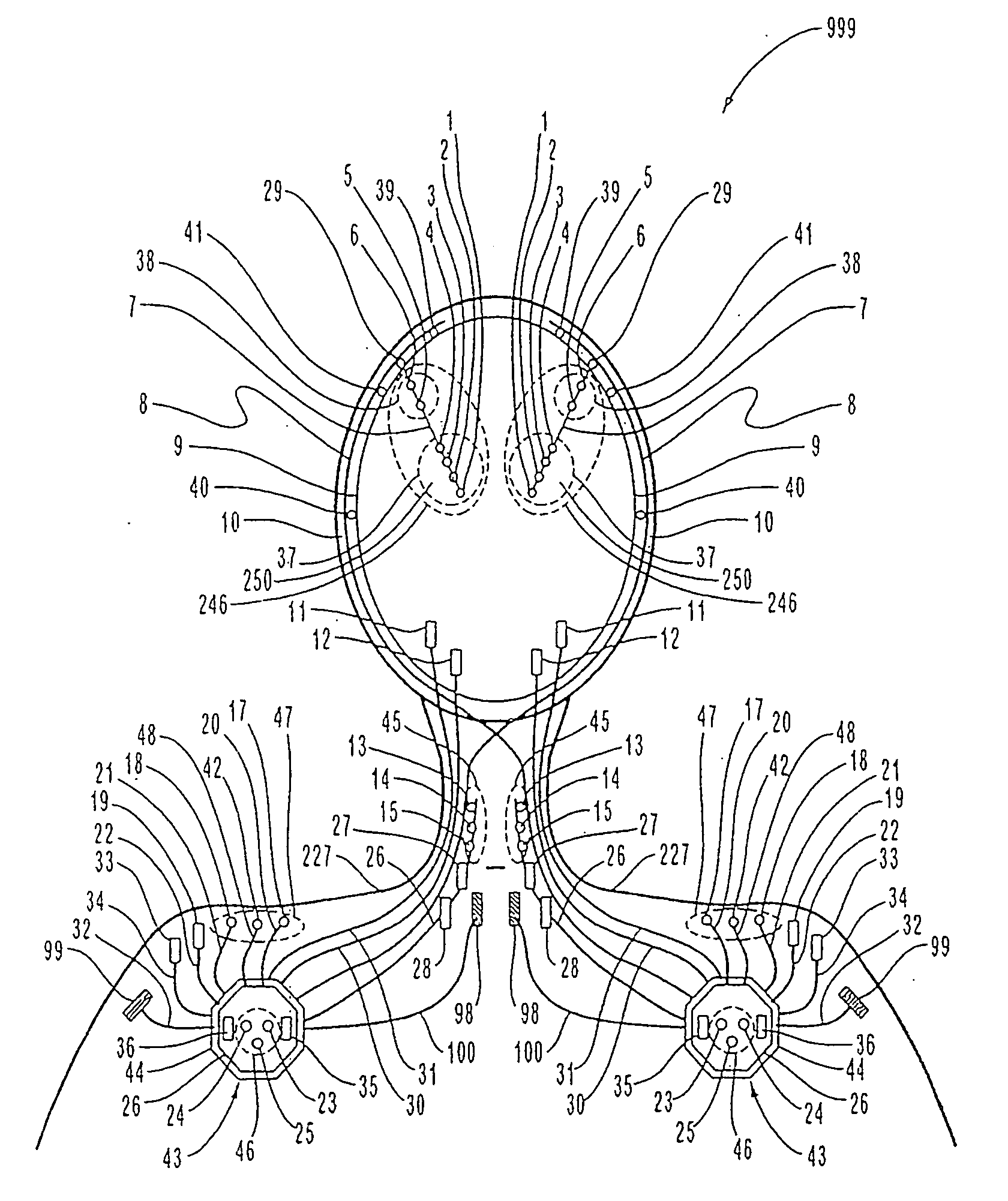 Methods and systems for continuous EEG monitoring