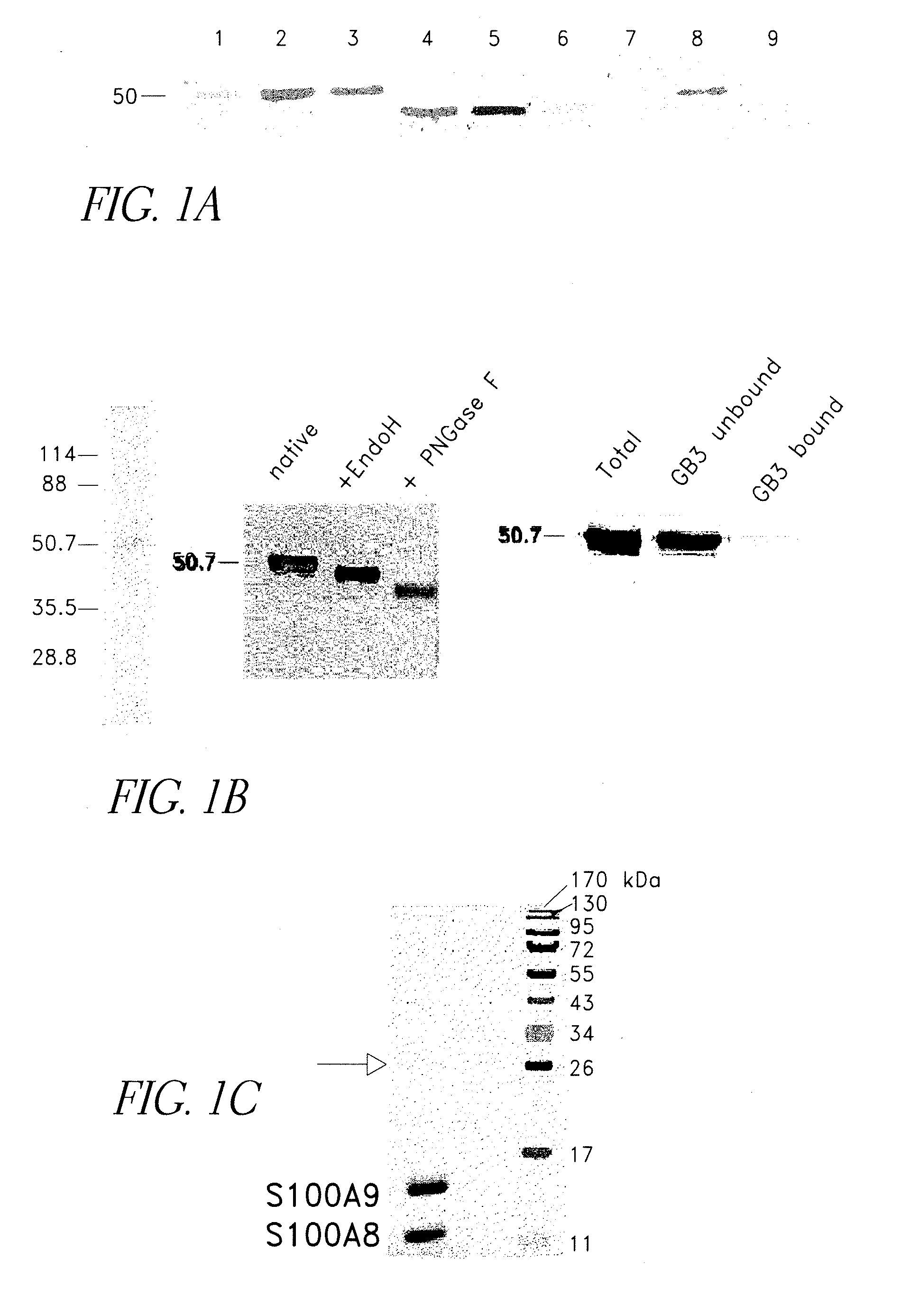 Methods for diagnosing and treating cancer