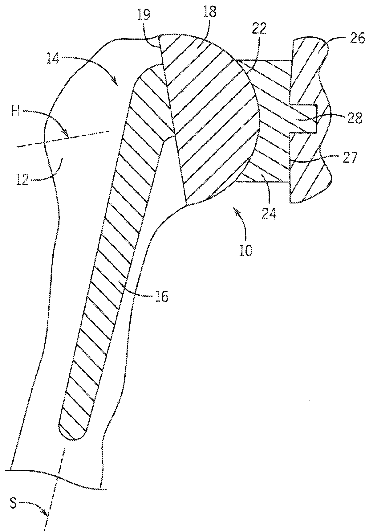 Shoulder prosthesis with variable inclination humeral head component