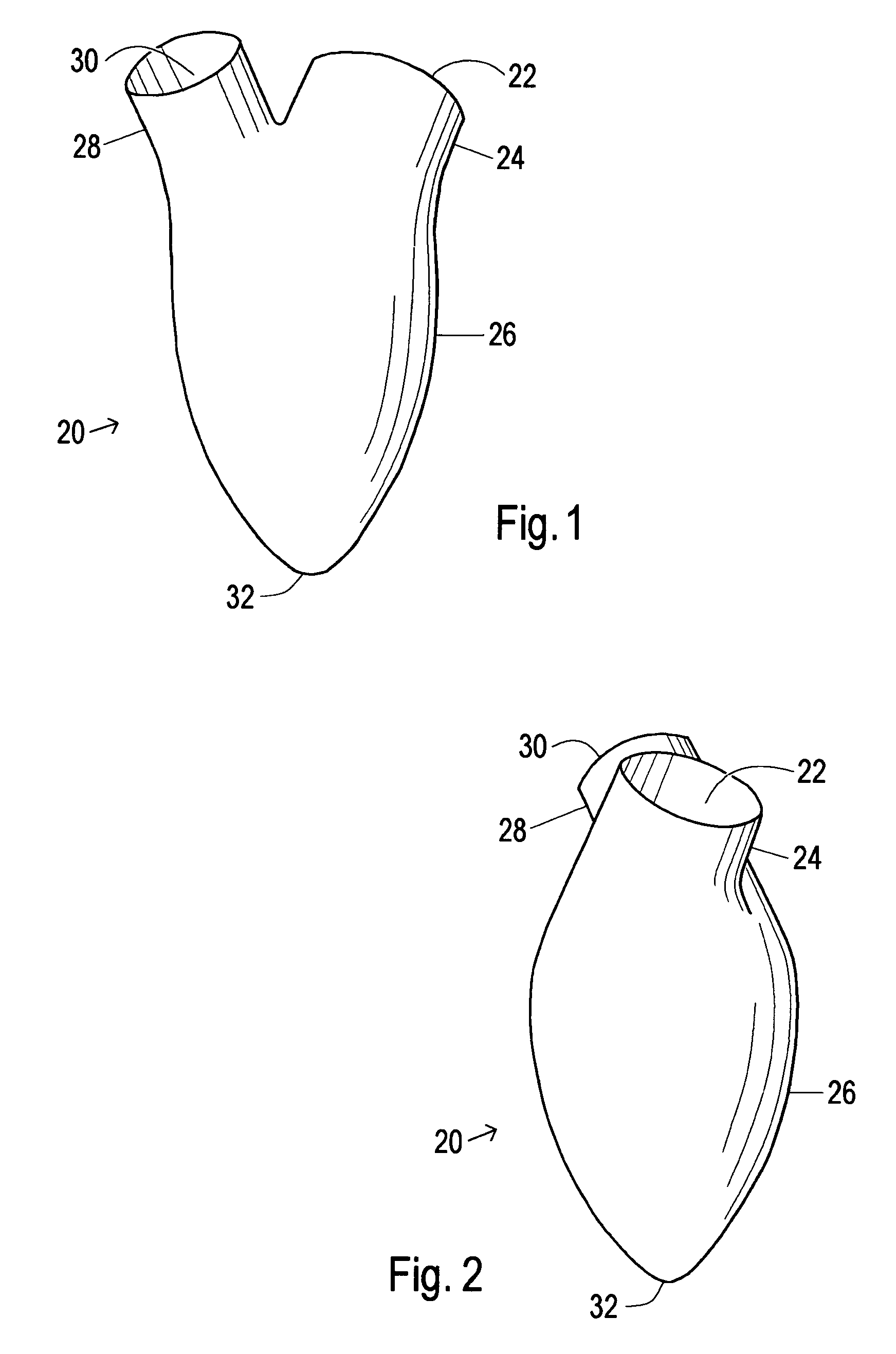 Device and method to limit filling of the heart