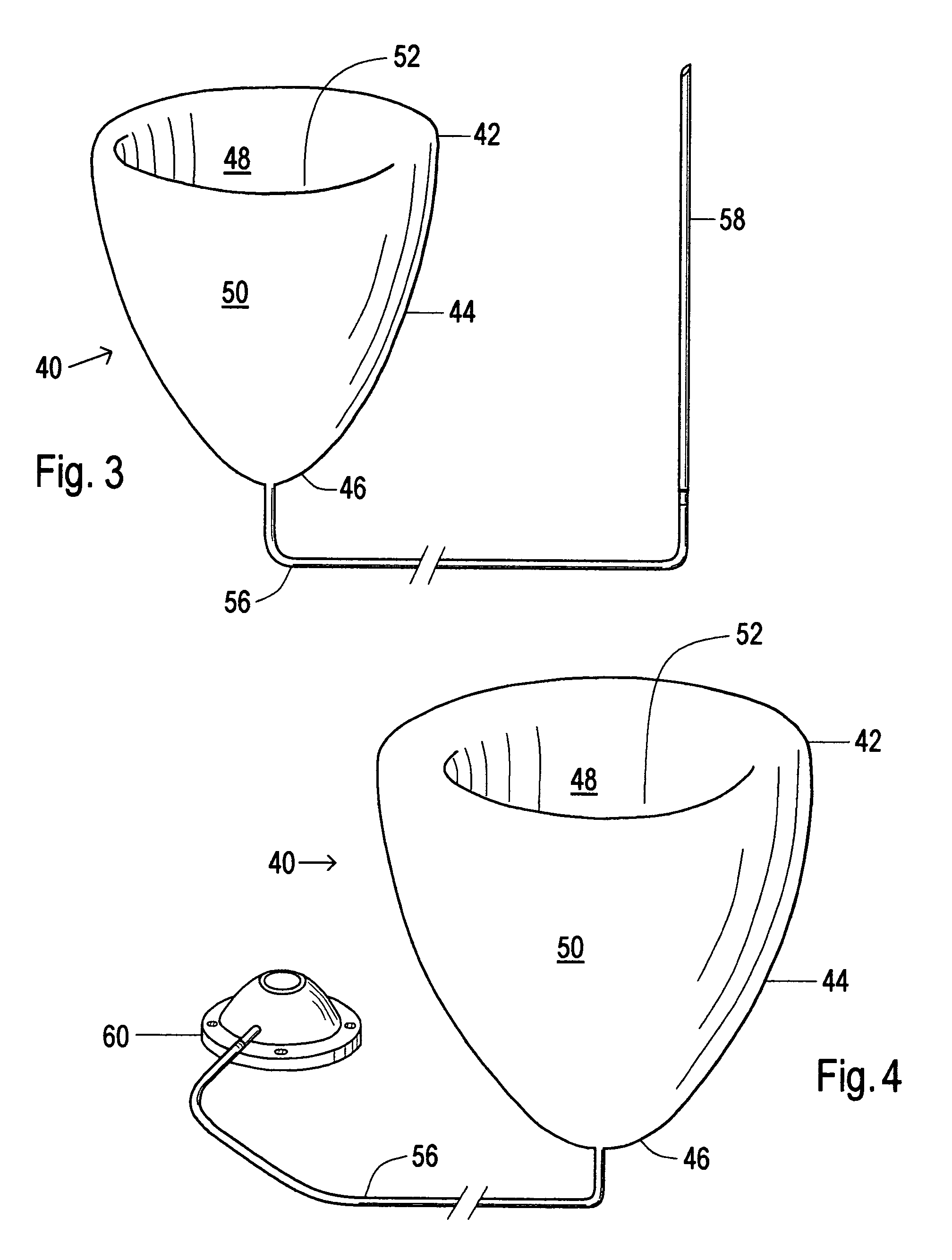 Device and method to limit filling of the heart