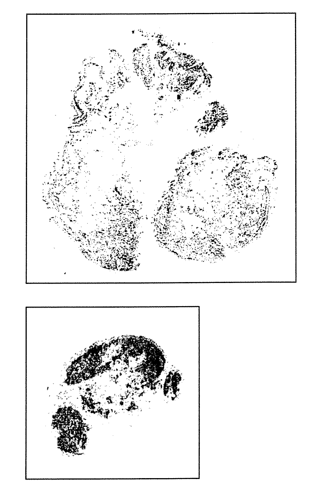 Inhibitors of Dkk-1