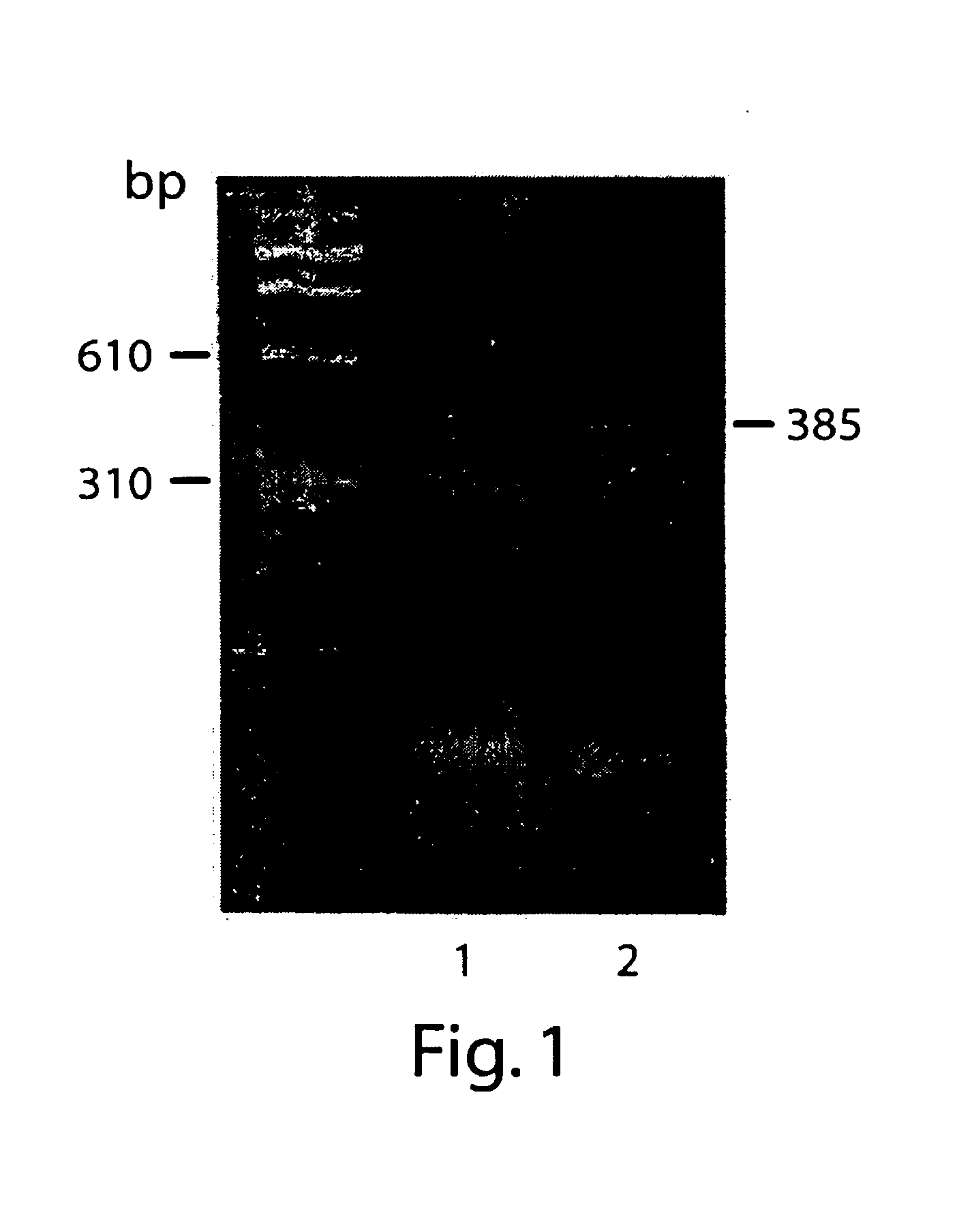 Methods and compositions for treatment of inflammatory disease using cadherin-11 modulating agents