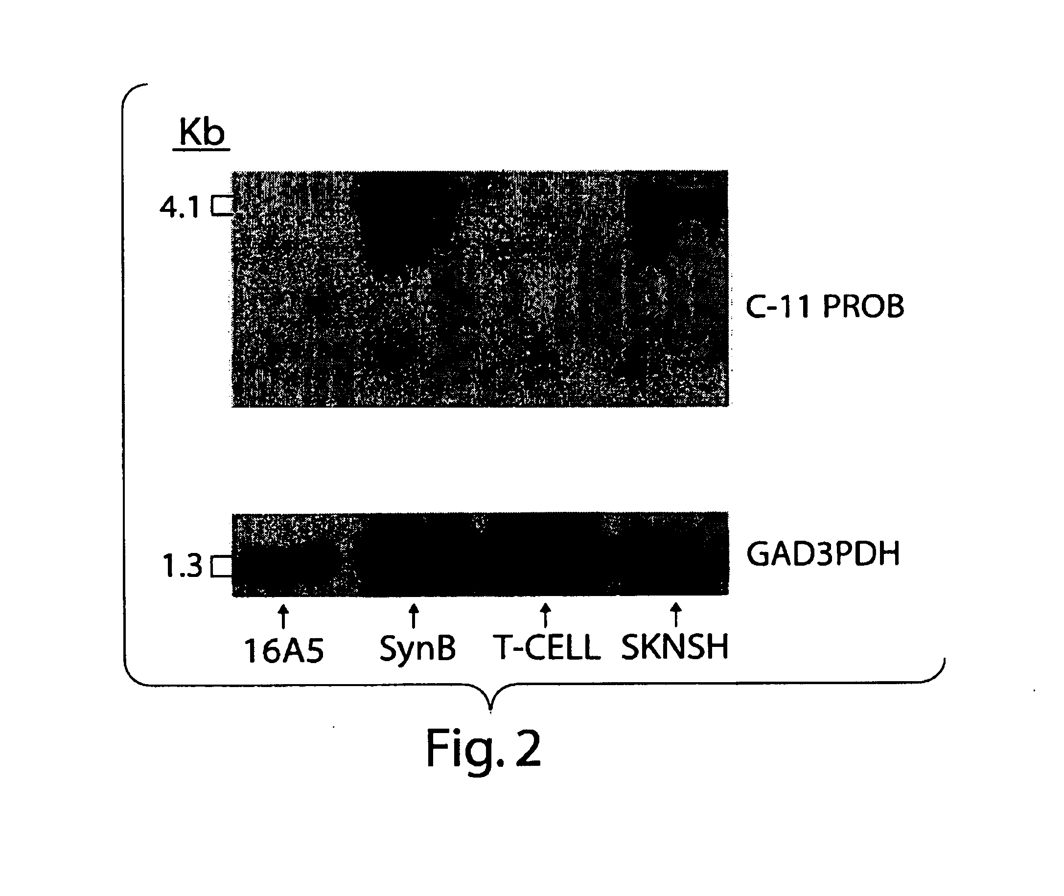 Methods and compositions for treatment of inflammatory disease using cadherin-11 modulating agents