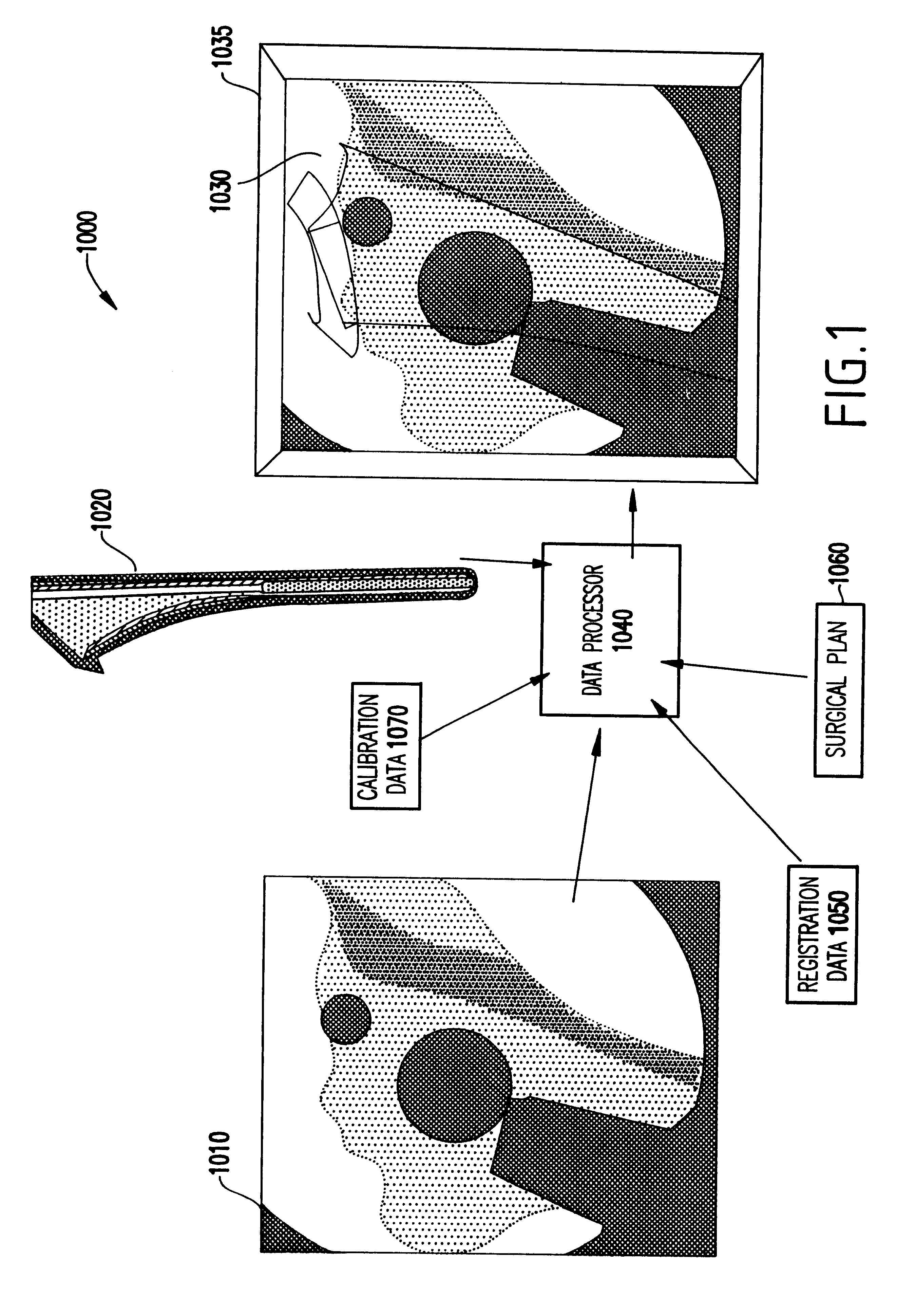 System and method for fusing three-dimensional shape data on distorted images without correcting for distortion