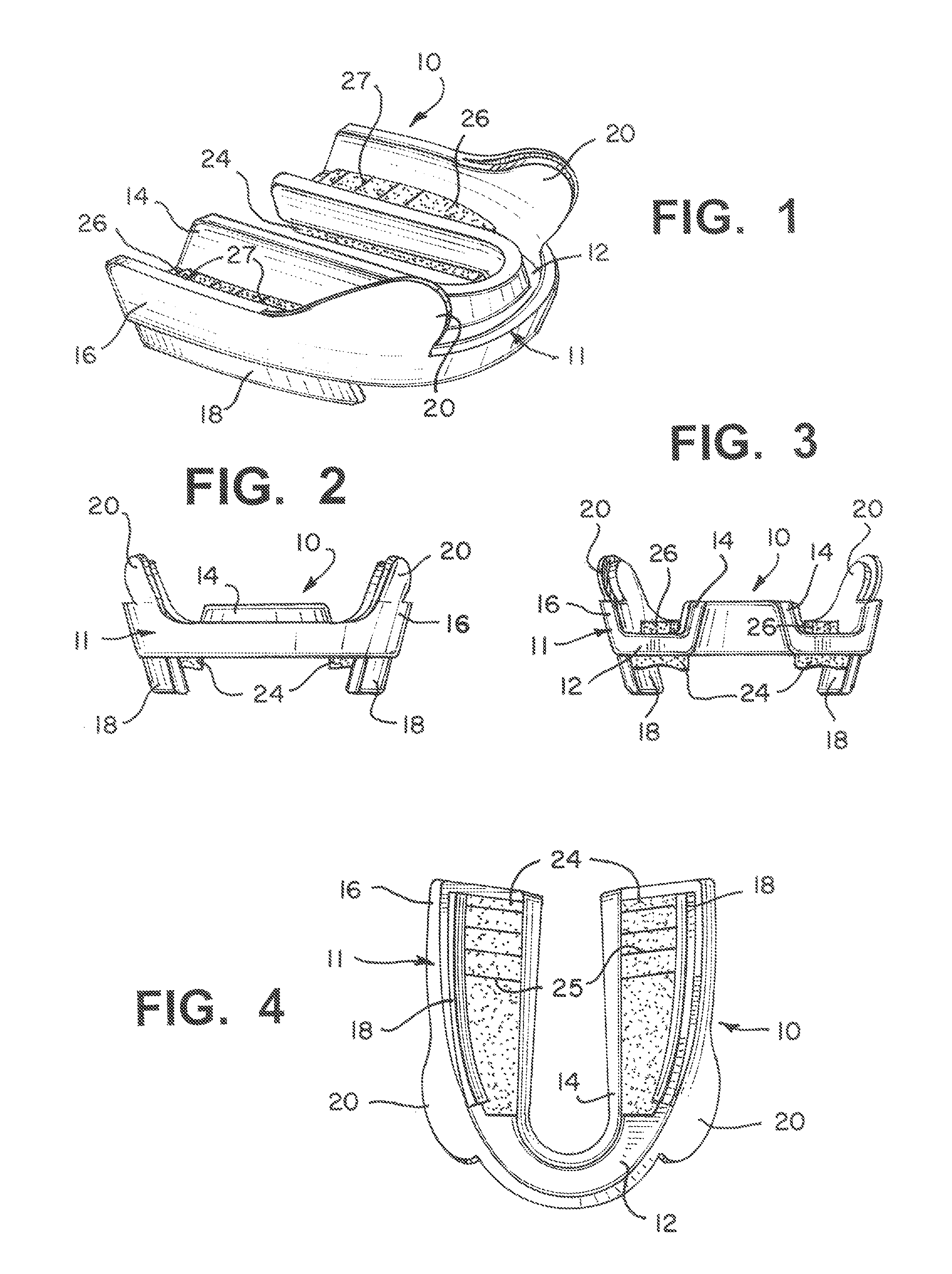 Dental appliance and method of fitting