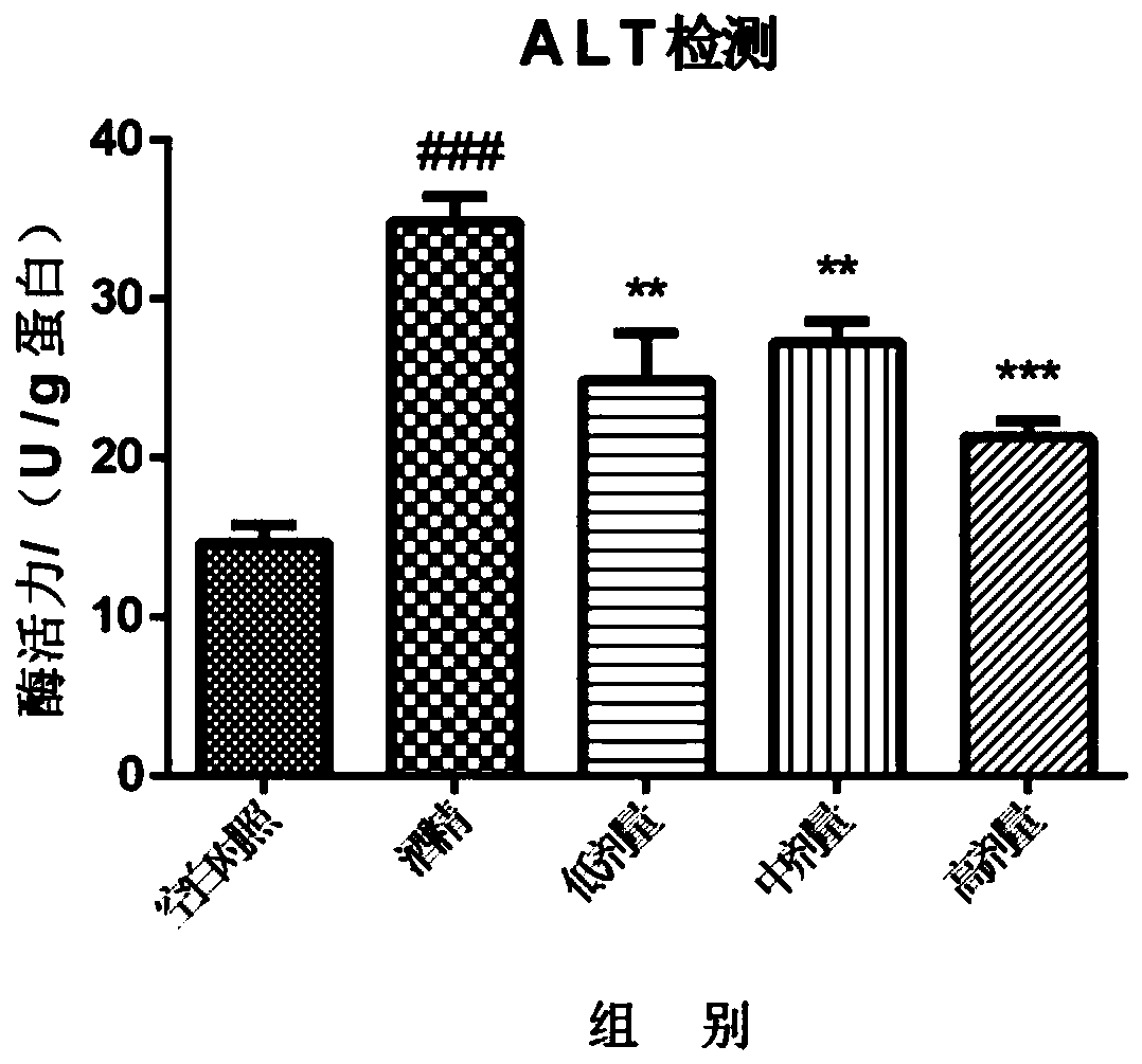 Liver-protection compound traditional Chinese medicine preparation and preparation method thereof