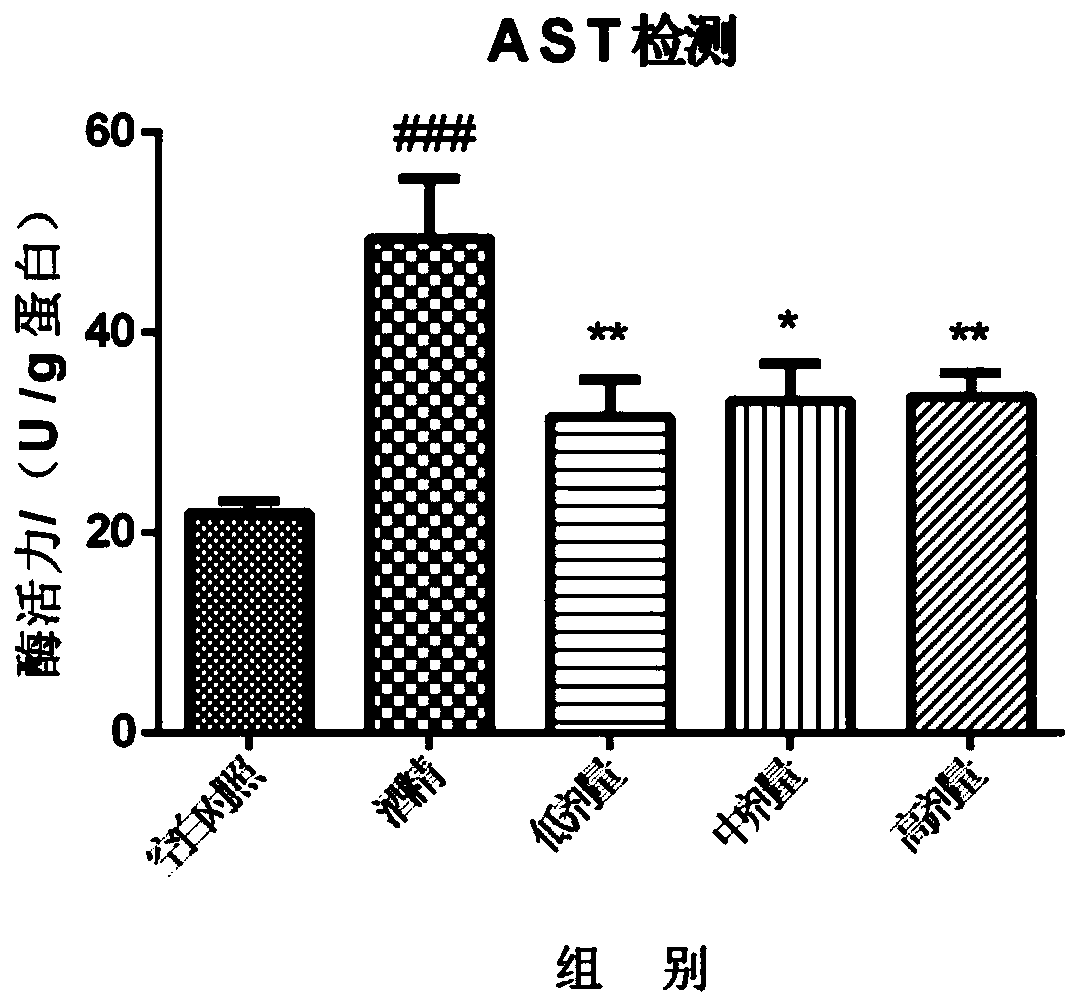 Liver-protection compound traditional Chinese medicine preparation and preparation method thereof