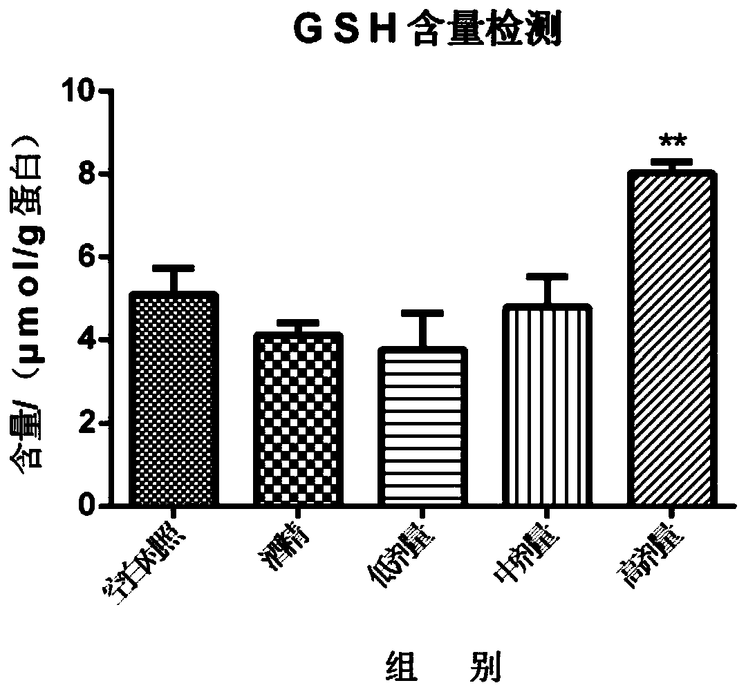 Liver-protection compound traditional Chinese medicine preparation and preparation method thereof