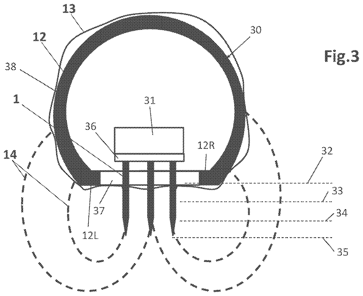 RF fractional device for treatment at different tissue depths