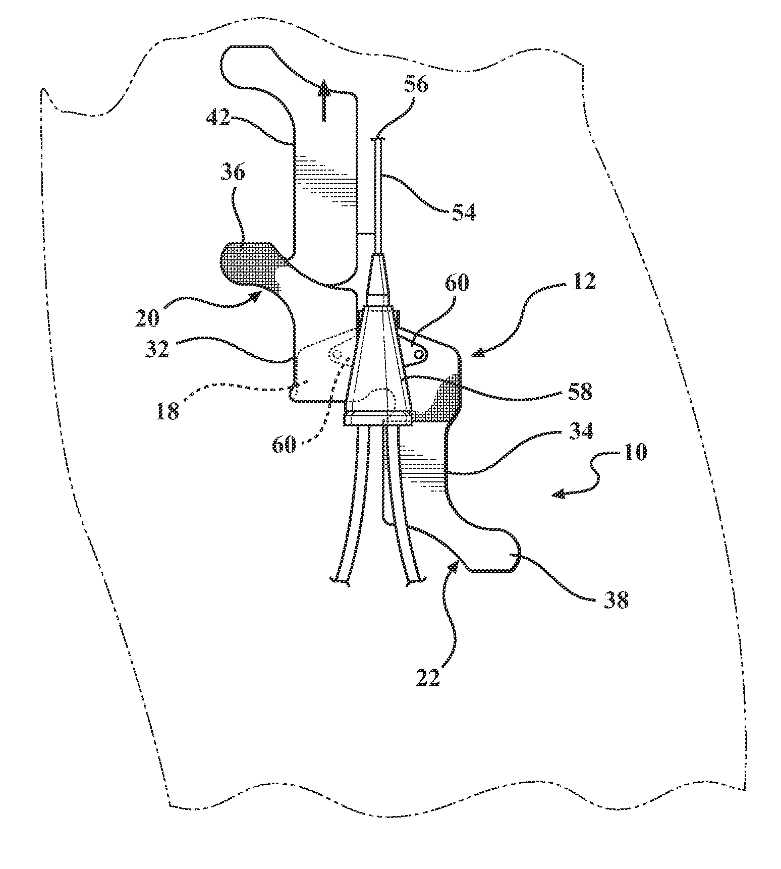 Catheter securement device to secure silicone winged piccs