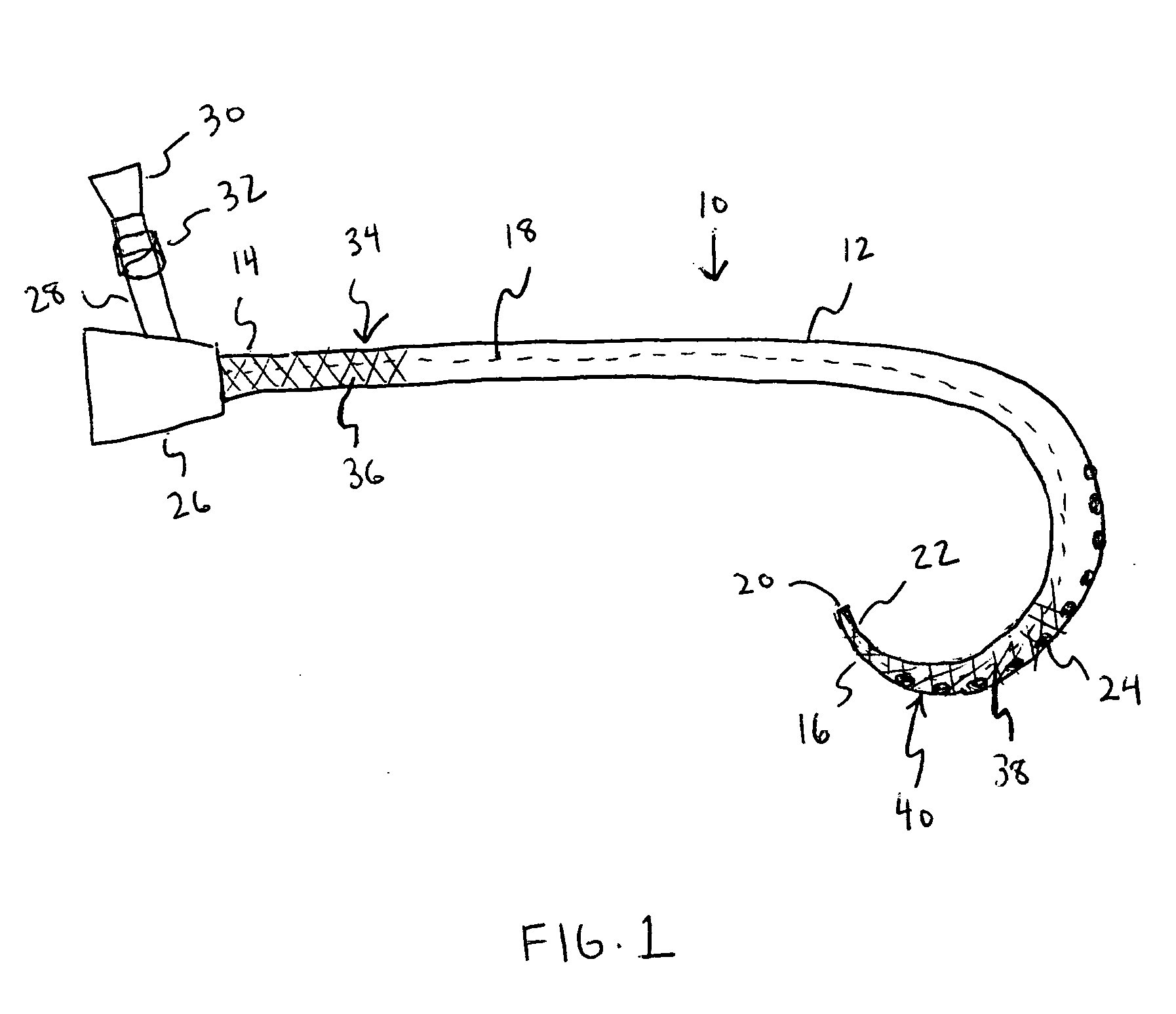 Catheter with polymeric coating