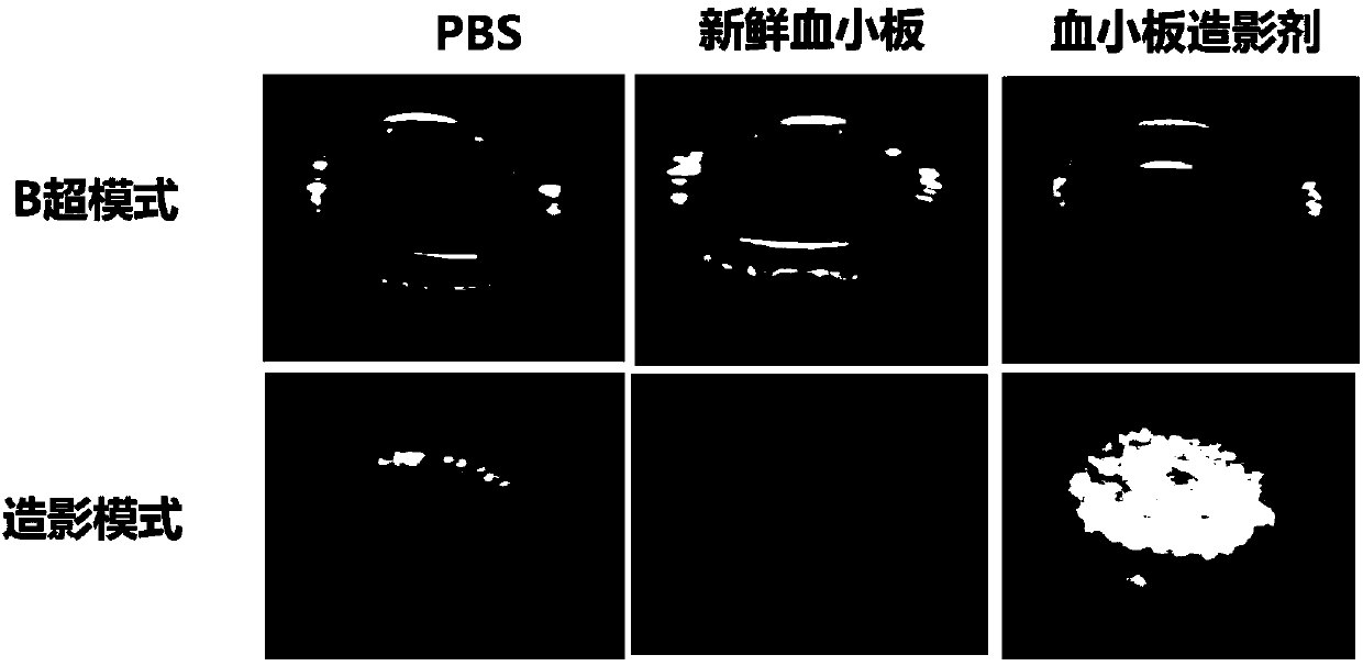 Preparation and application of natural cell membrane derived novel ultrasonic contrast agent