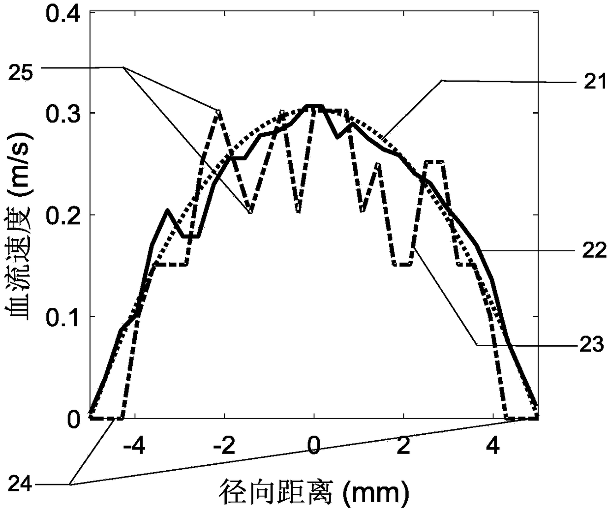 Ultrasonic blood flow velocity field measurement of optimal frame interval tracking estimation