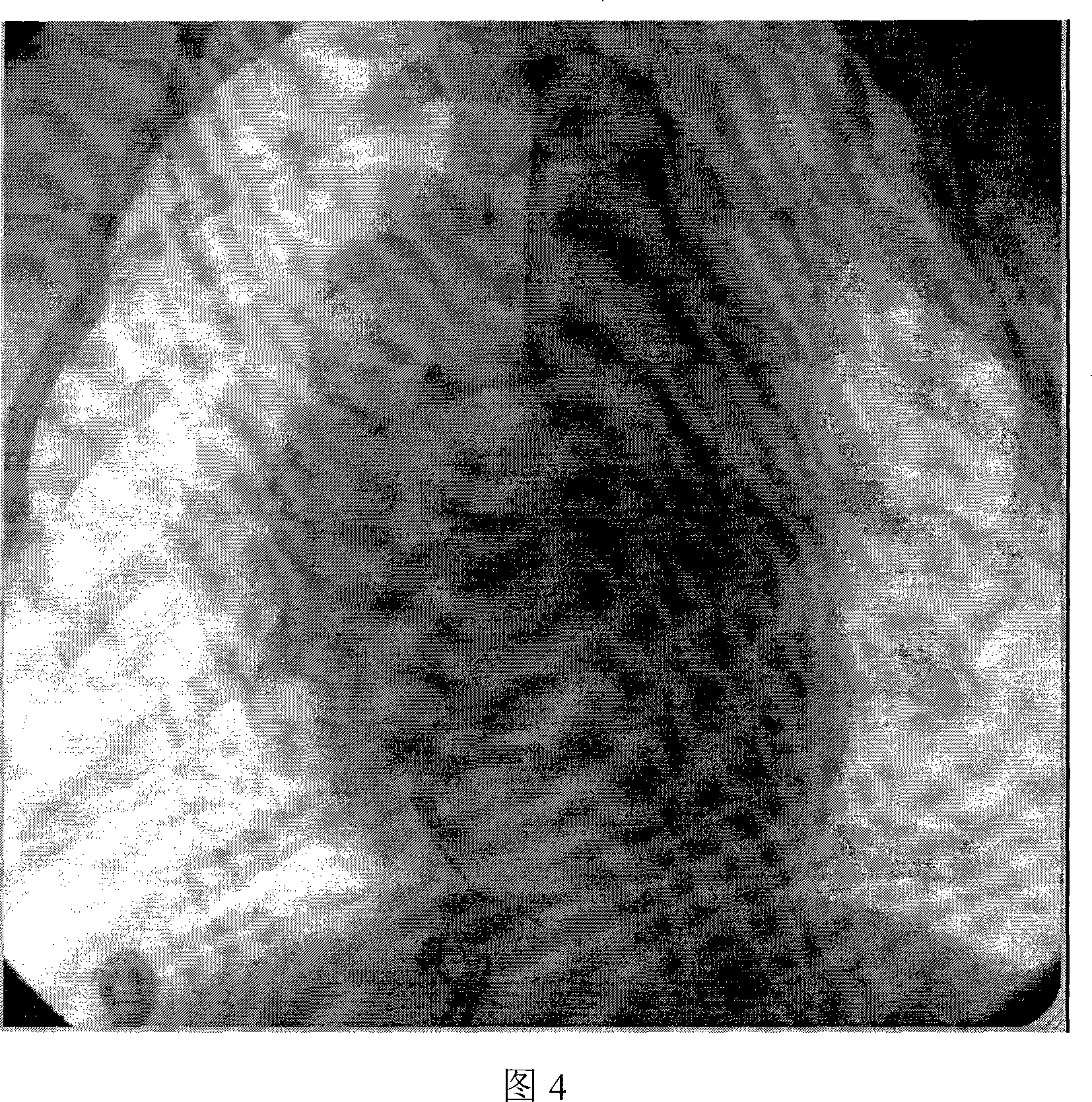 Establishing beagle dog myocardial infarction model using polythene foam plugging method