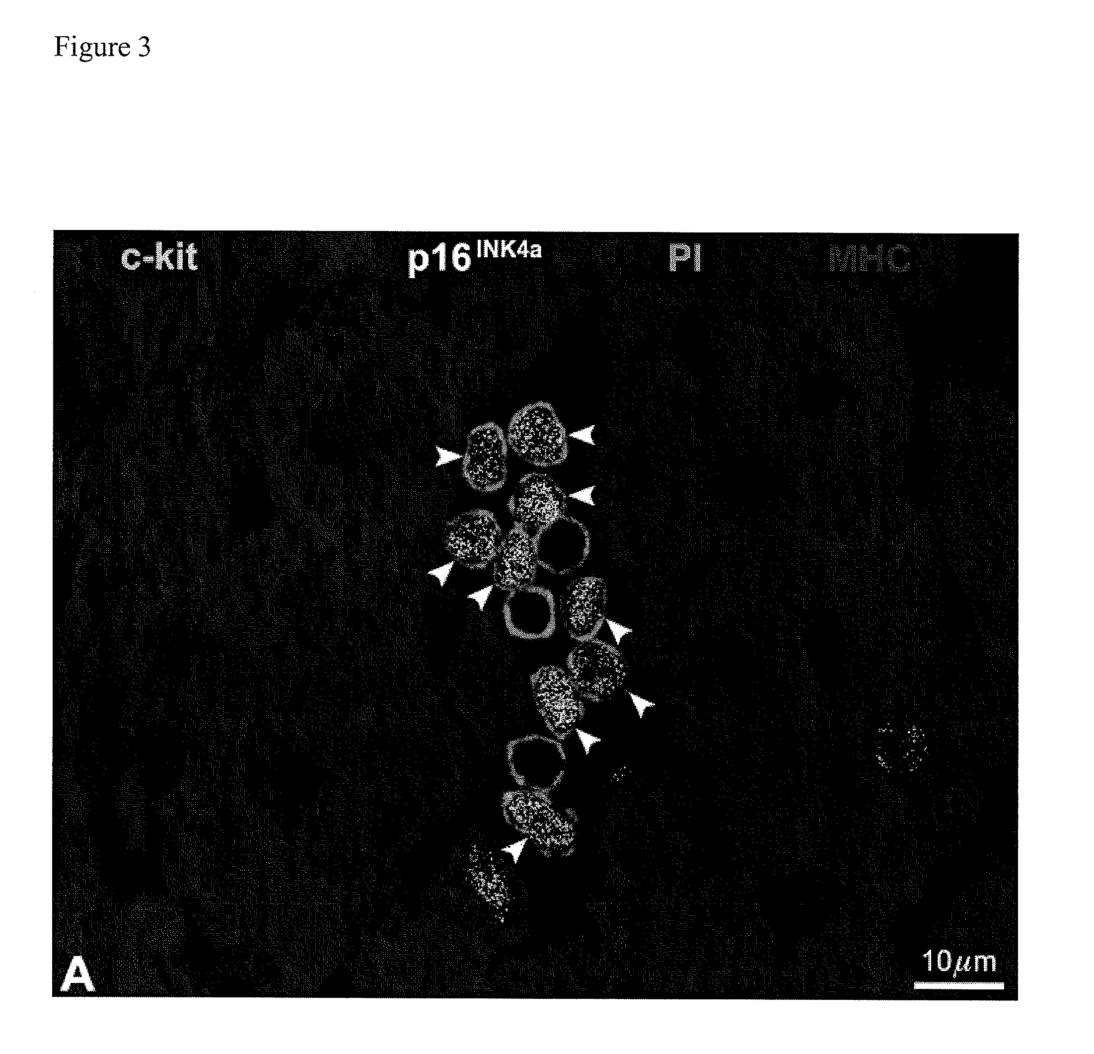 Methods of isolating non-senescent cardiac stem cells and uses thereof