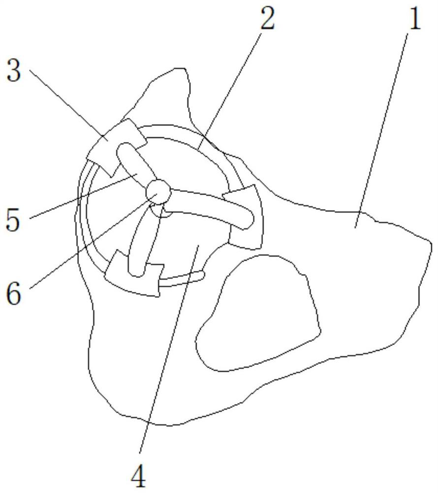 Hip center of rotation locator