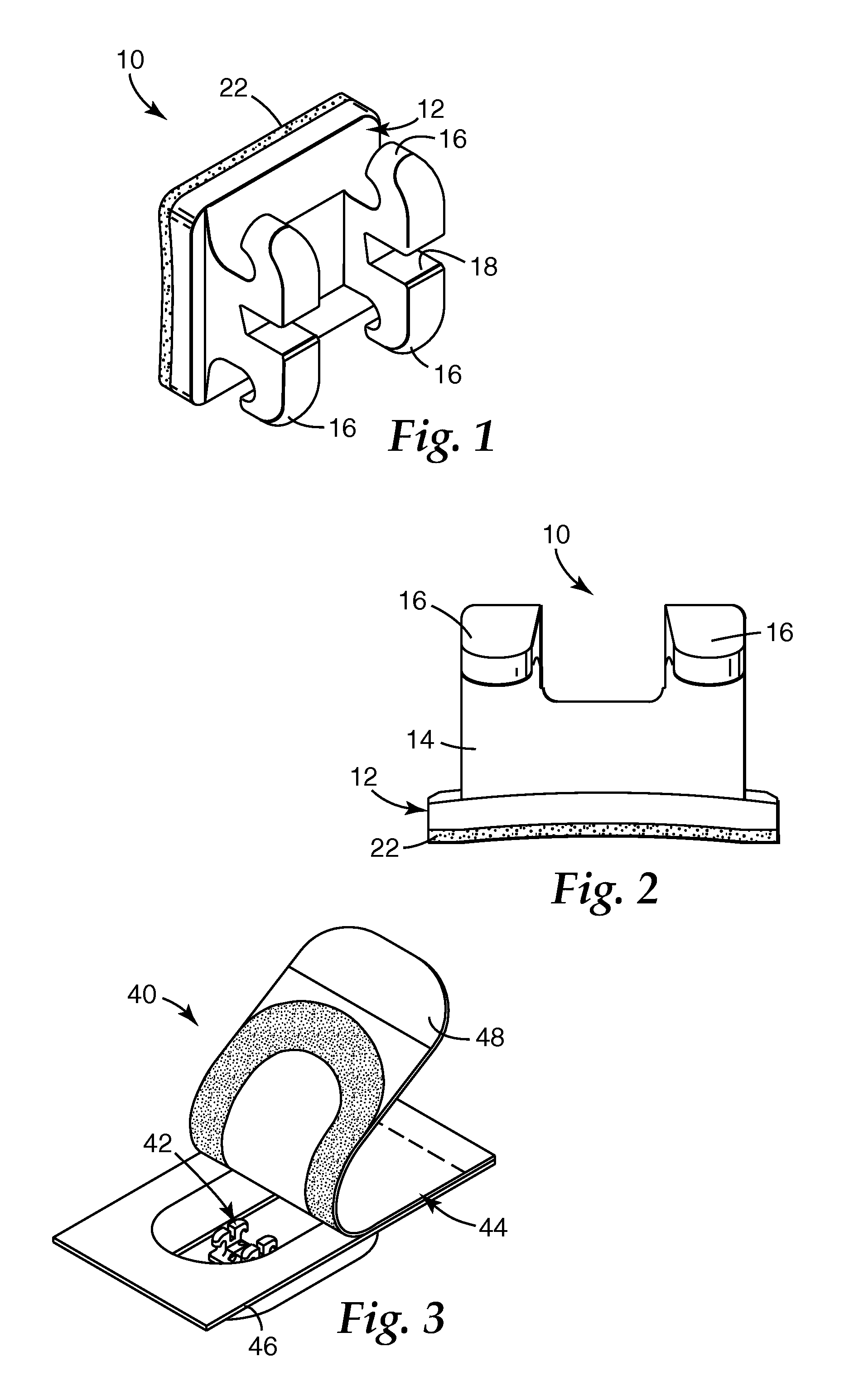 Dental compositions including a thermally labile component, and the use thereof