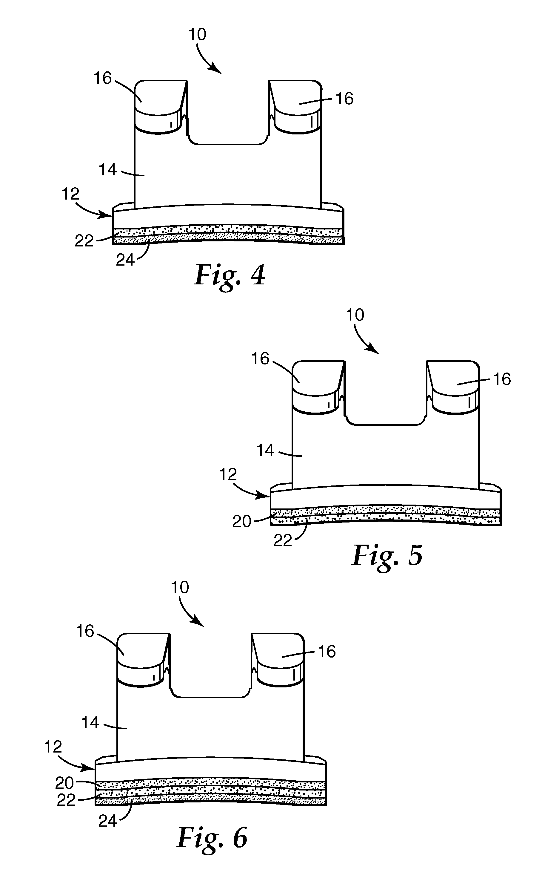 Dental compositions including a thermally labile component, and the use thereof