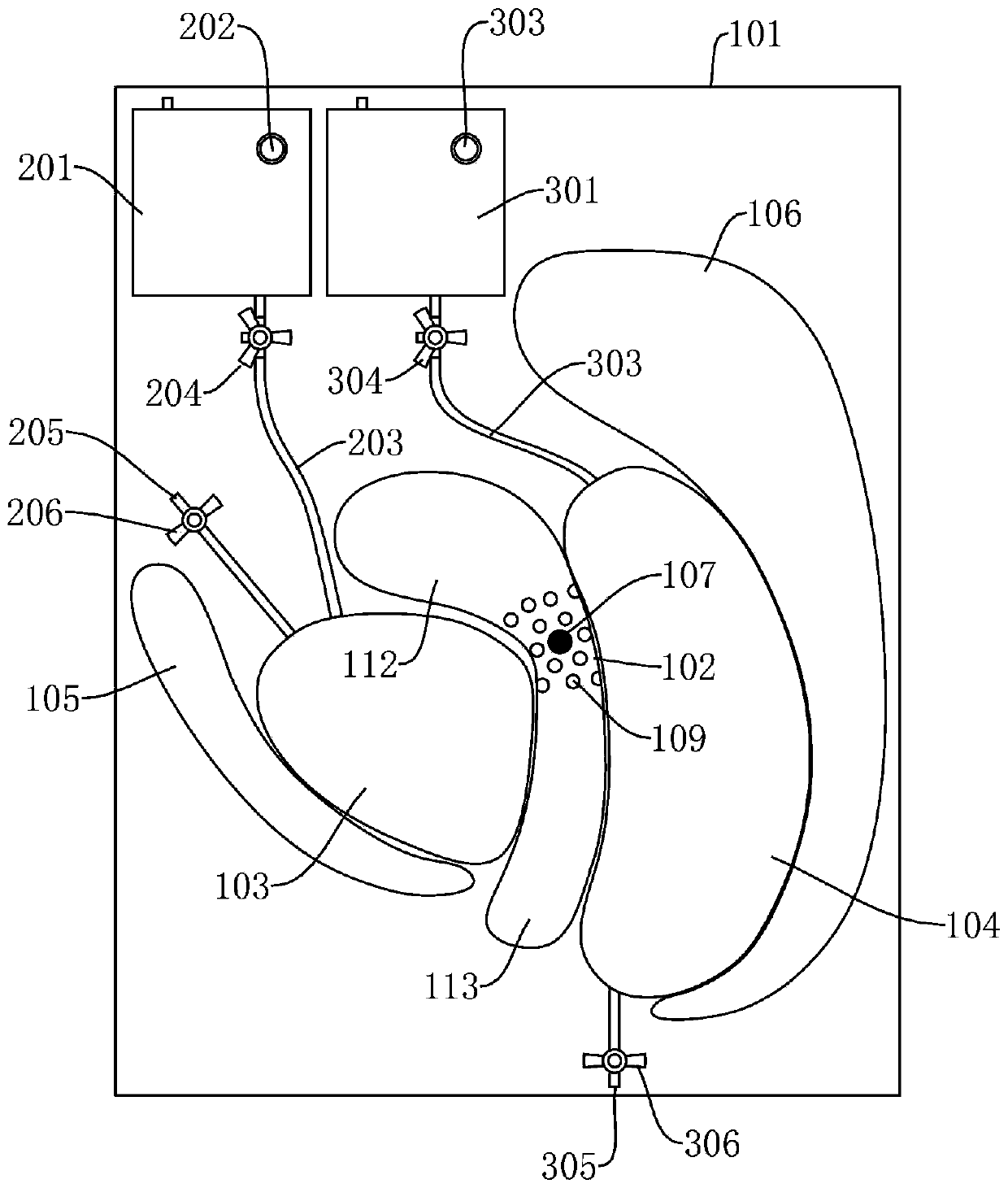 Demonstration and education system for female pelvic tumor patients