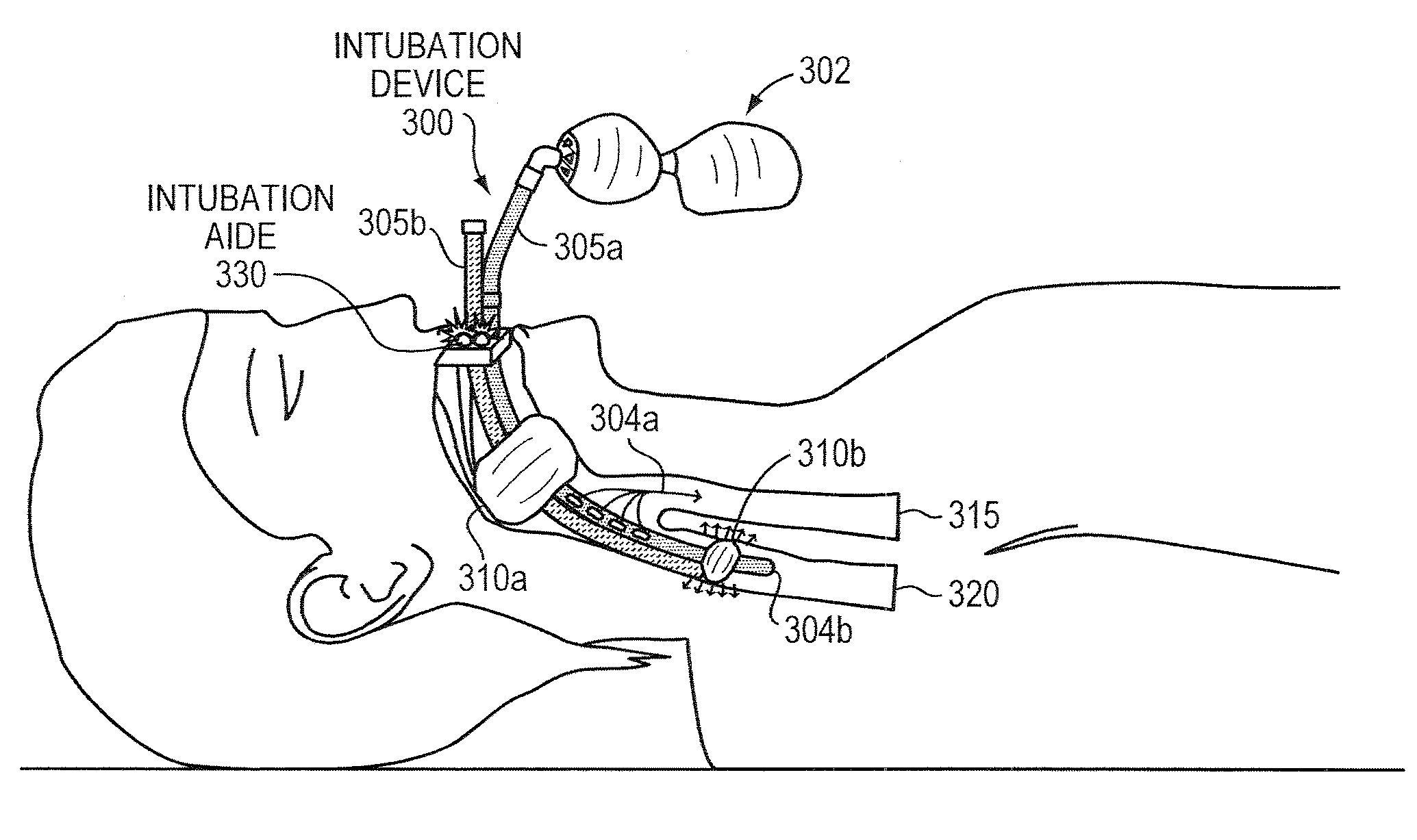 Methods and apparatus for safe application of an intubation device