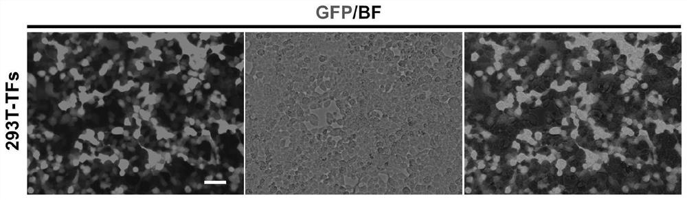 Method for preparing human-derived dorsal root node neurons with age characteristics through non-nerve cell transformation