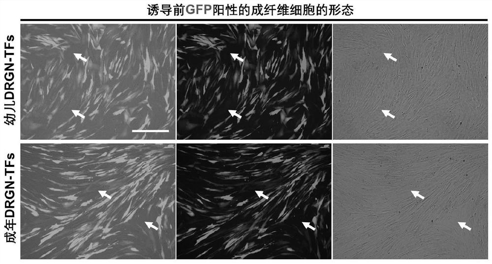 Method for preparing human-derived dorsal root node neurons with age characteristics through non-nerve cell transformation