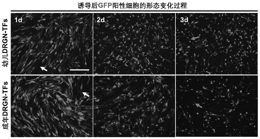 Method for preparing human-derived dorsal root node neurons with age characteristics through non-nerve cell transformation