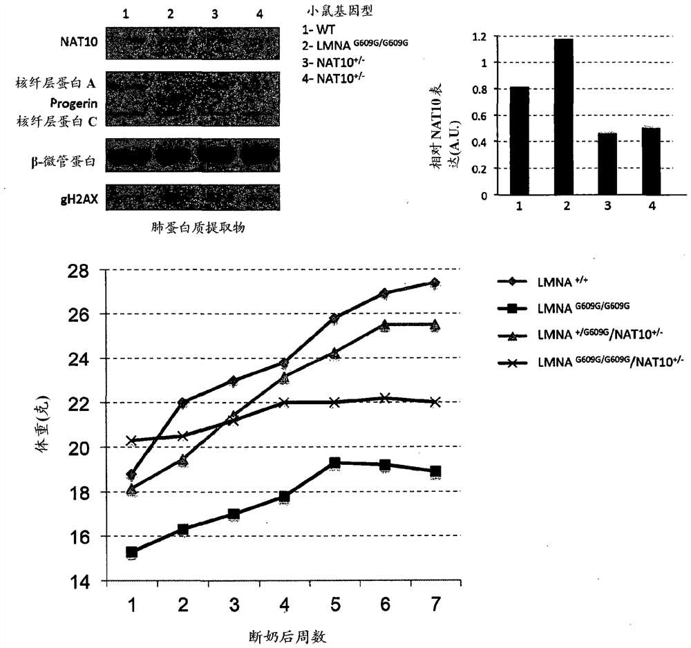 Nat10 modulators for the treatment or prevention of laminopathy, aging and cancer