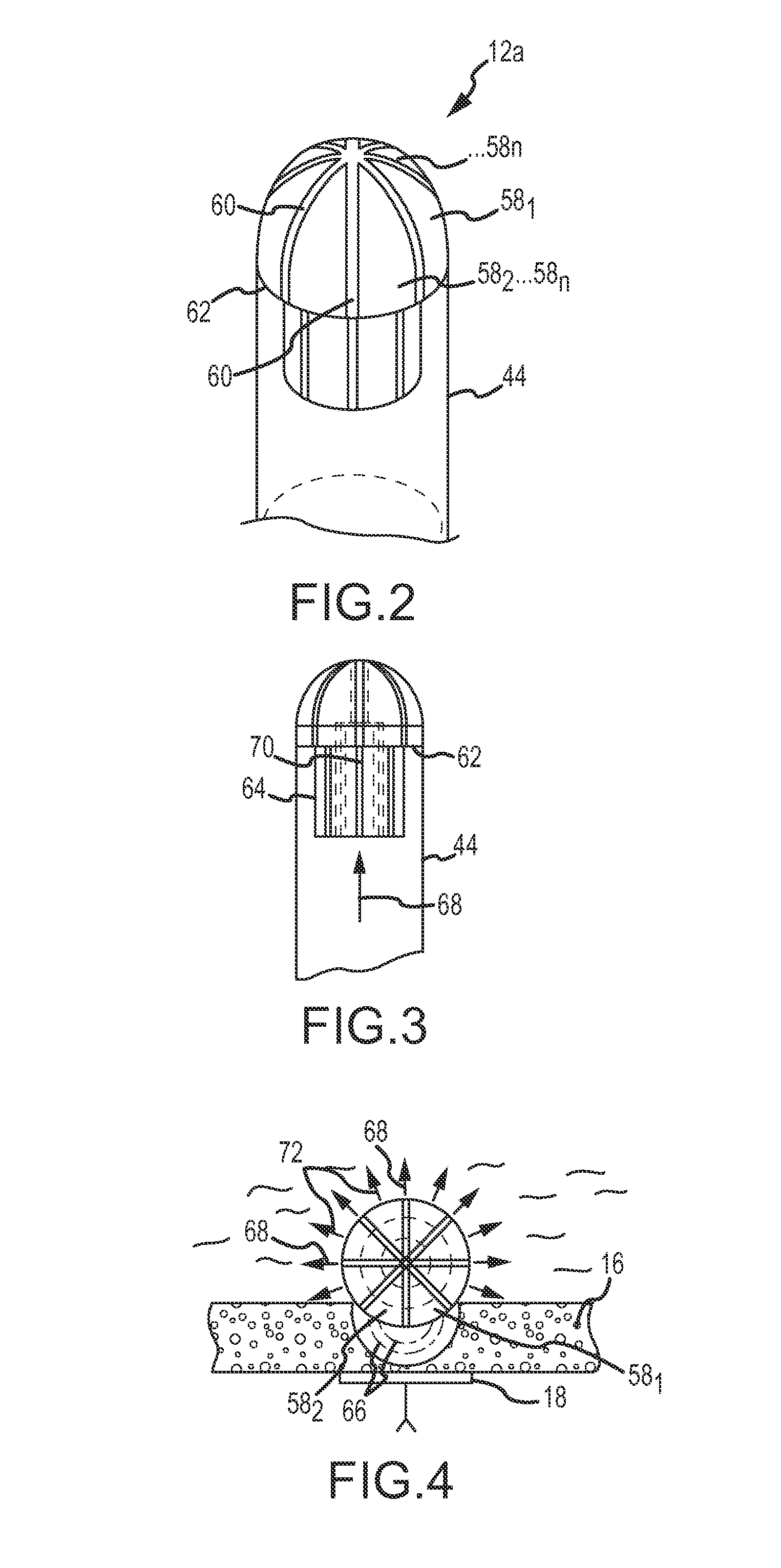 System for electroporation therapy