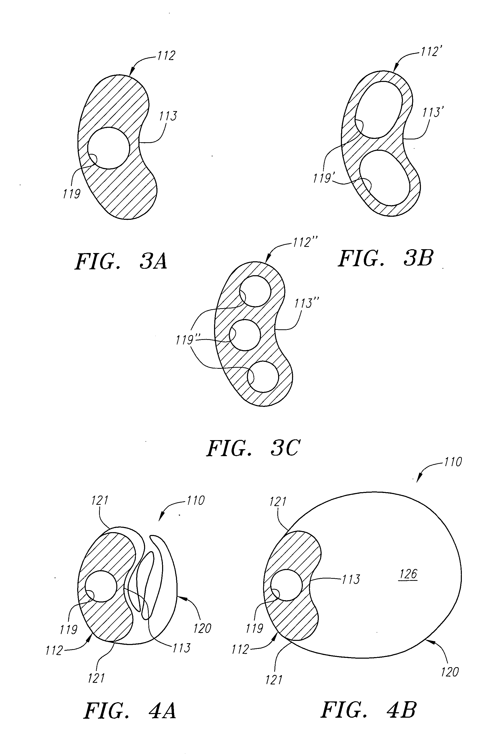 Expandable guide sheath and apparatus with distal protection and methods for use