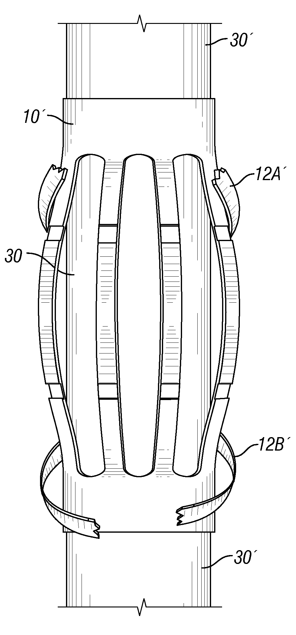 Apparatus for and Method of Deploying a Centralizer Installed on an Expandable Casing String