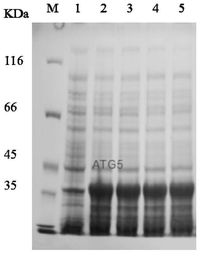 Tick ​​autophagy-related protein molecule atg5 and its application