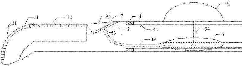 Gradient array ultrasonic imaging guidance ablation catheter