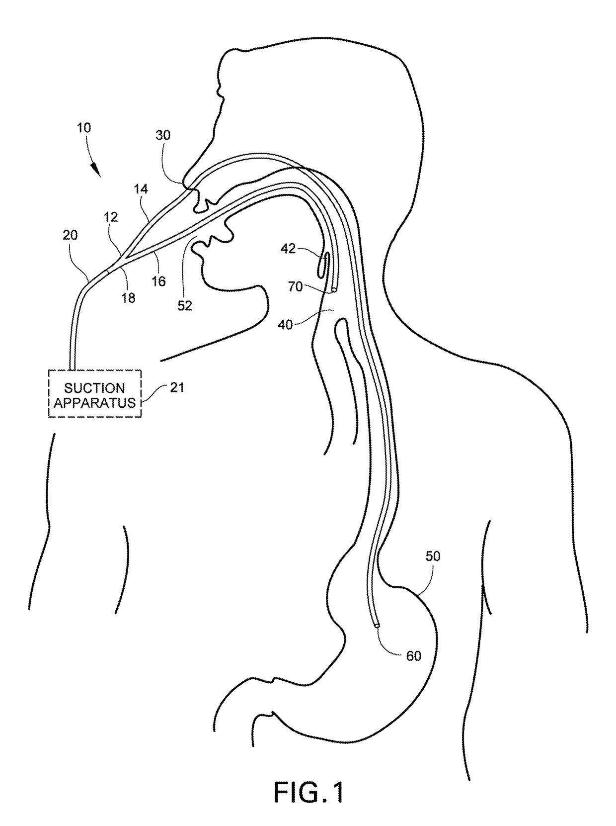 Medical Apparatus With Hypopharyngeal Suctioning Capability