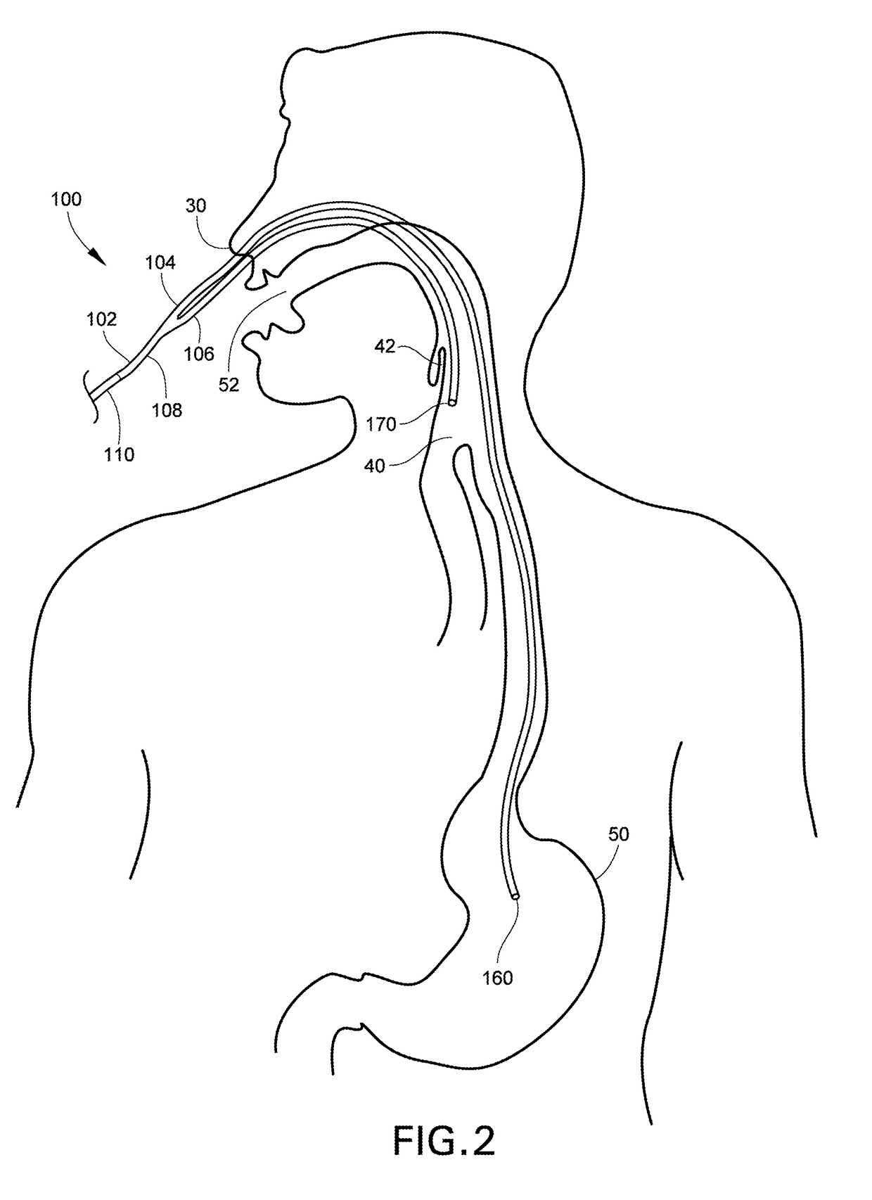 Medical Apparatus With Hypopharyngeal Suctioning Capability