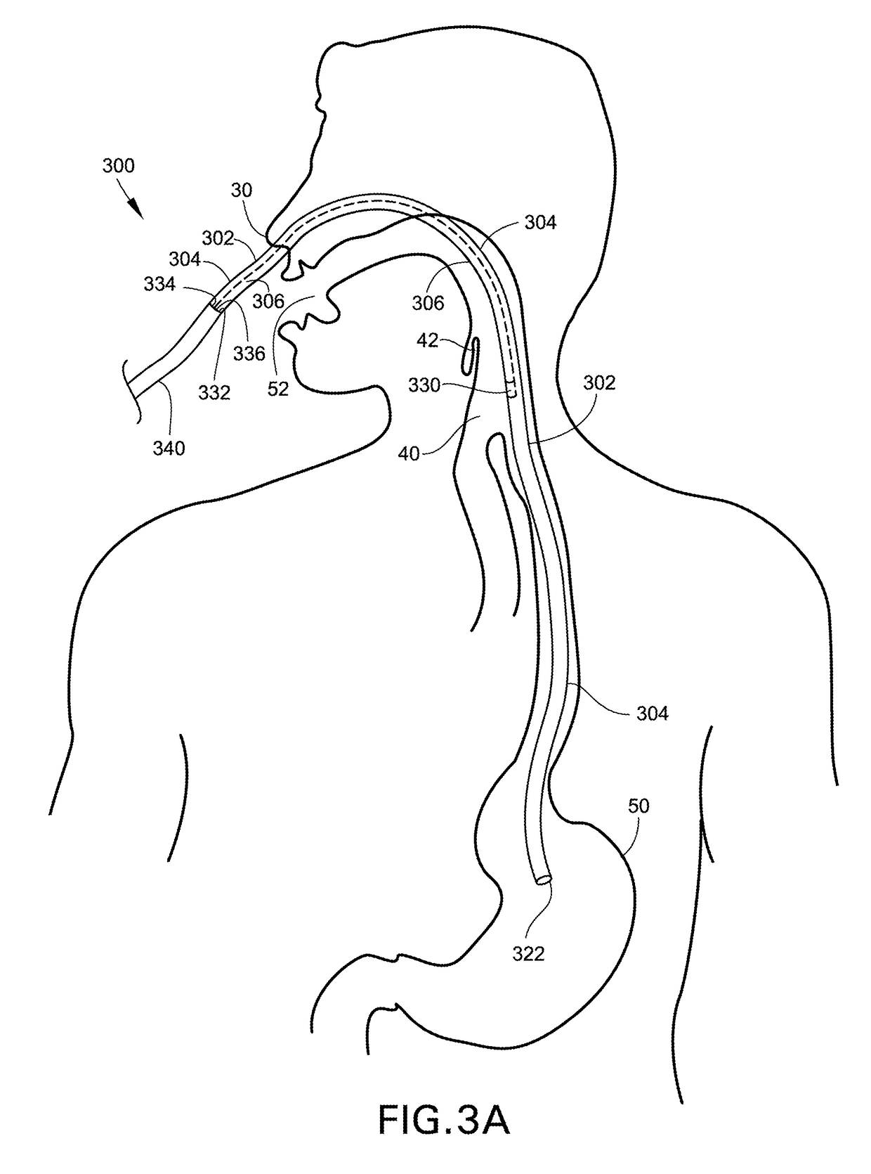 Medical Apparatus With Hypopharyngeal Suctioning Capability