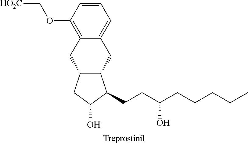 Intermediate for synthesizing treprostinil diethanolamine and method for preparing the same