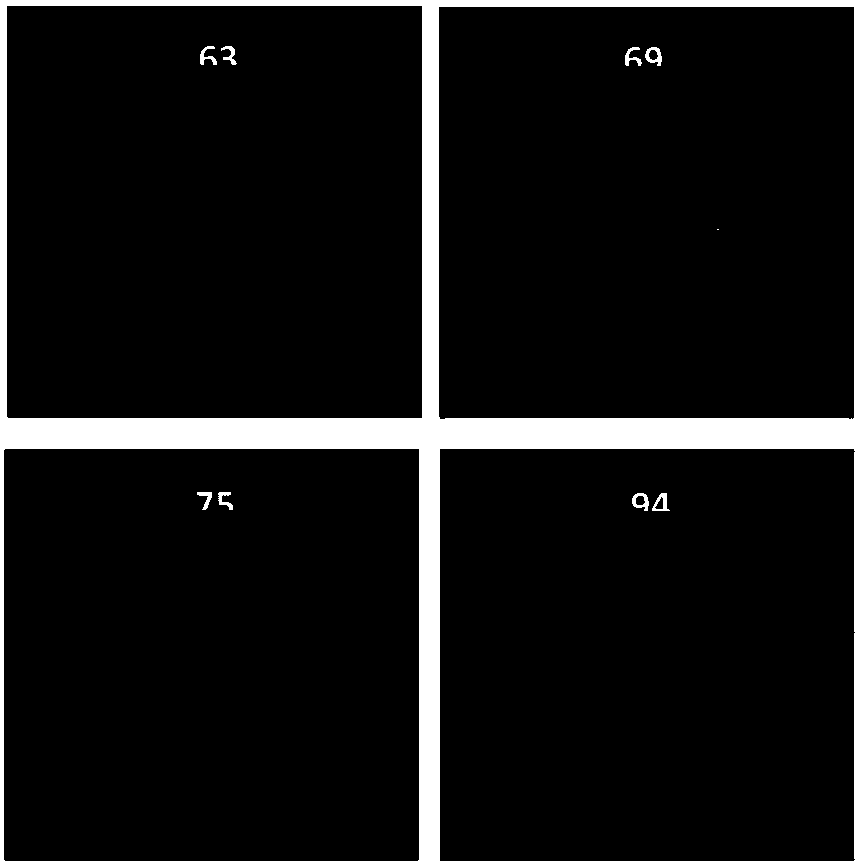 Manufacturing method and application of immunoliposome compound nanoparticle biochip