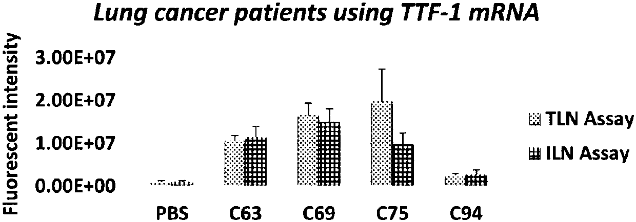 Manufacturing method and application of immunoliposome compound nanoparticle biochip