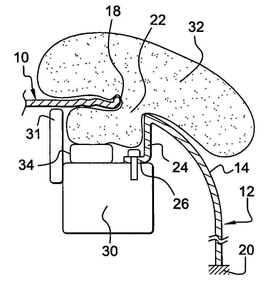 Use of a fender and a hood in combination with an air bag, fender retaining and support means, a fender, a fender module, and a hood for a motor vehicle