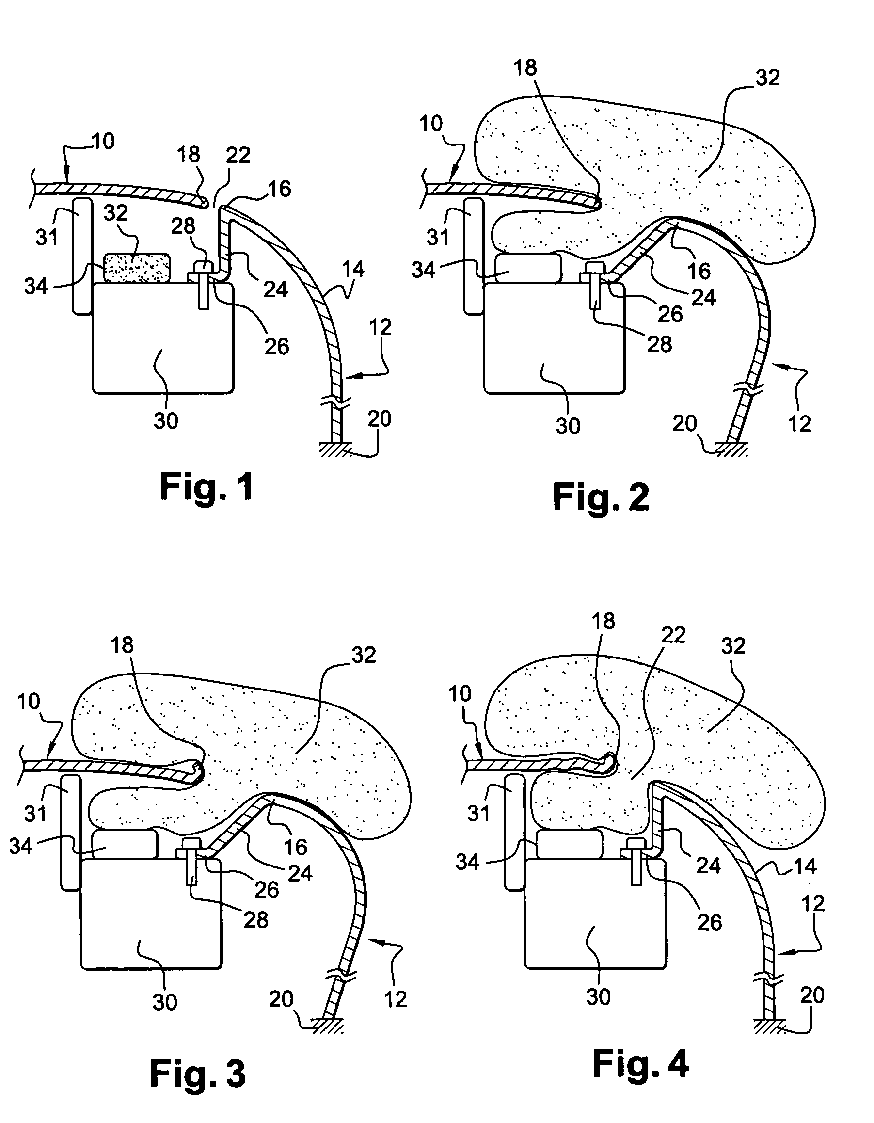 Use of a fender and a hood in combination with an air bag, fender retaining and support means, a fender, a fender module, and a hood for a motor vehicle