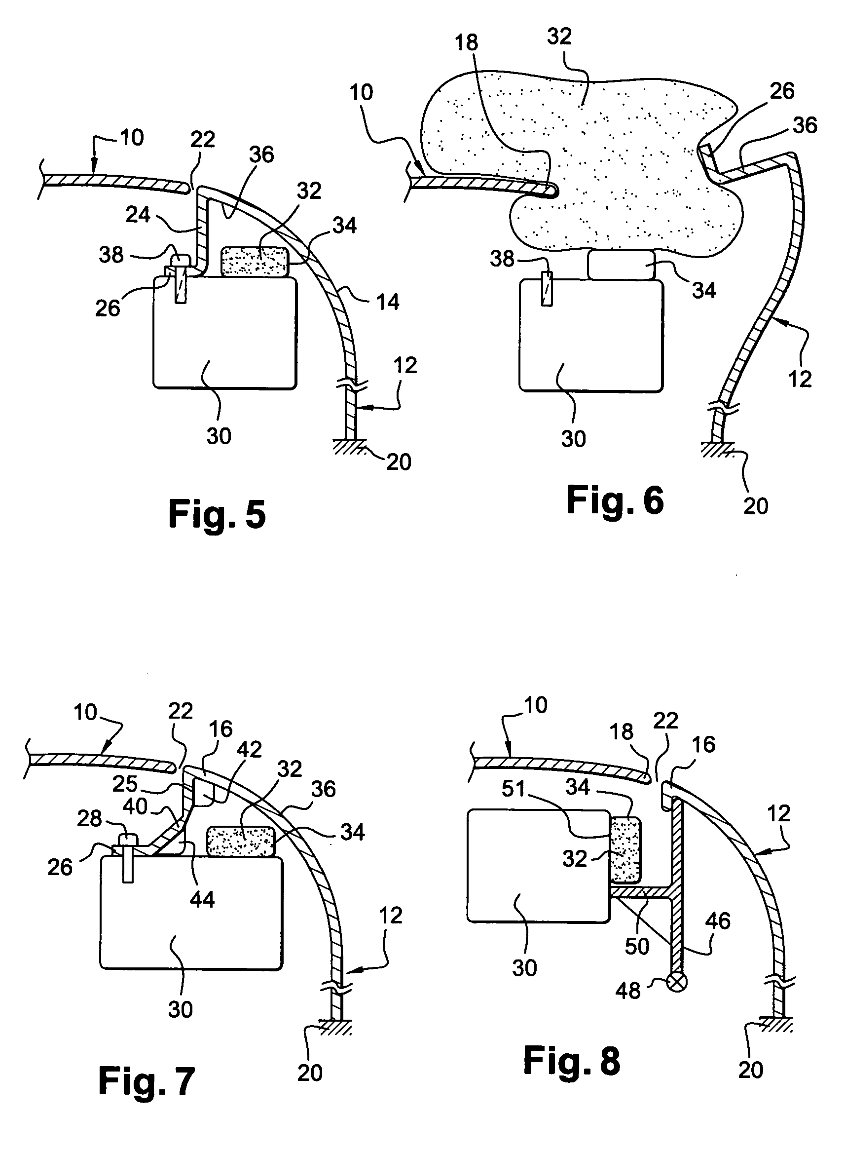 Use of a fender and a hood in combination with an air bag, fender retaining and support means, a fender, a fender module, and a hood for a motor vehicle