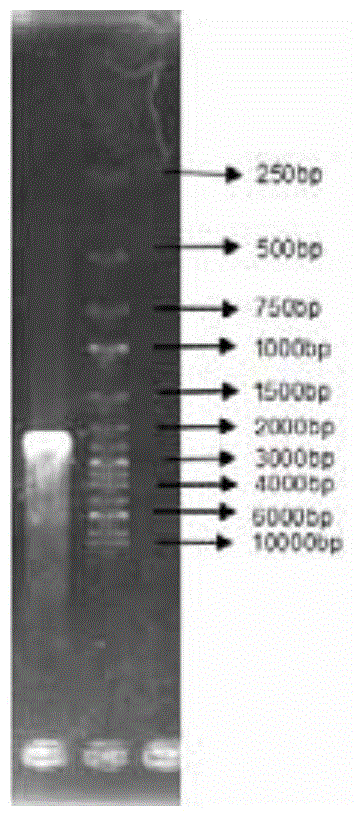 Escherichia coli strain for producing succinic acid with glycerol as well as construction method and use
