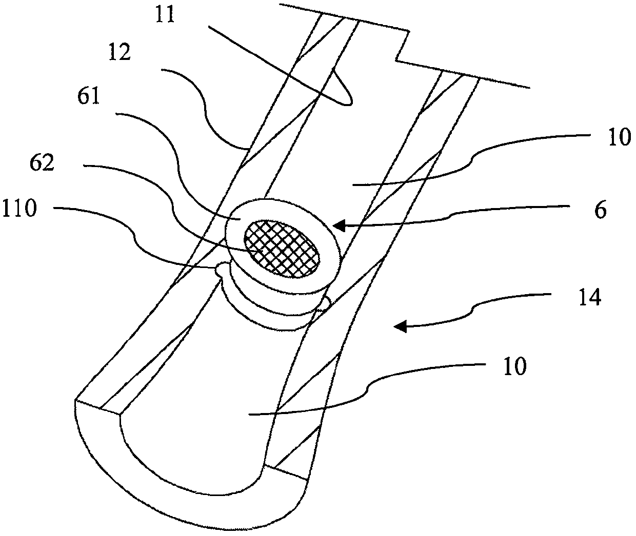 A stop-flow catheter